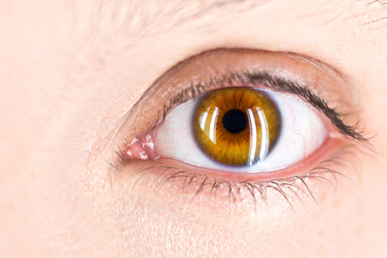 Close-up of a human eye with an amber iris and dark pupil, the part of the eye that a cataract can cloud