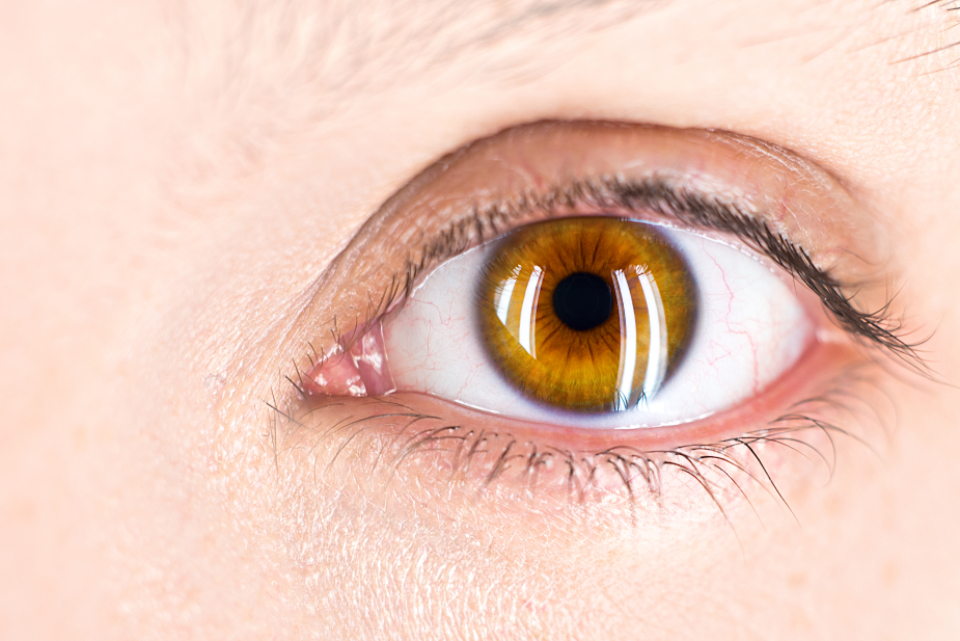 Close-up of a human eye with an amber iris and dark pupil, the part of the eye that a cataract can cloud