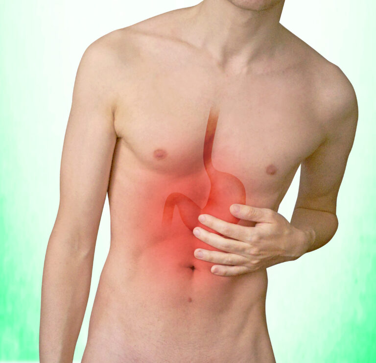Man holding his upper abdomen with the esophagus and stomach highlighted in red to show reflux discomfort